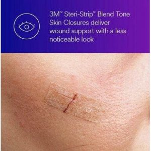 3M-3M-Steri-Strip-Blend-Tone-Skin-Closures-3_396x